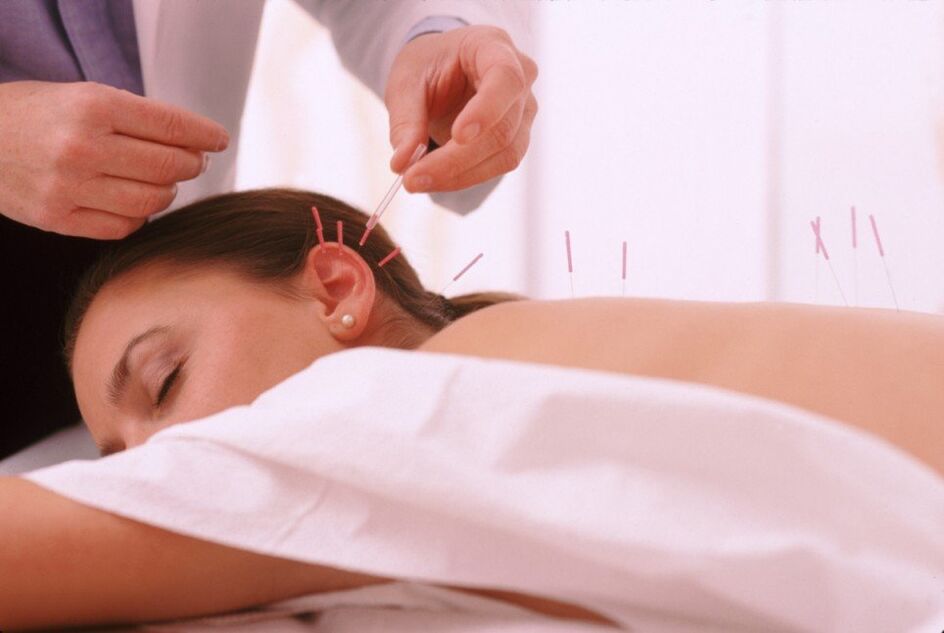 Acupuntura y acupuntura con osteocondrosis cervical
