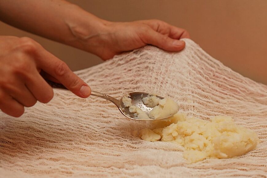 Comprimir de miel y papas