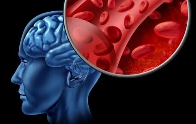 Hambre de oxígeno del cerebro