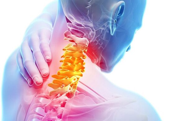 Las causas de la osteocondrosis cervical
