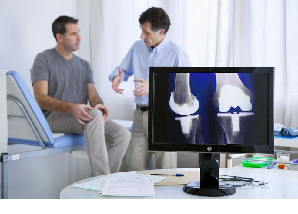 Artrosis de la articulación de la rodilla en la imagen X -Ray